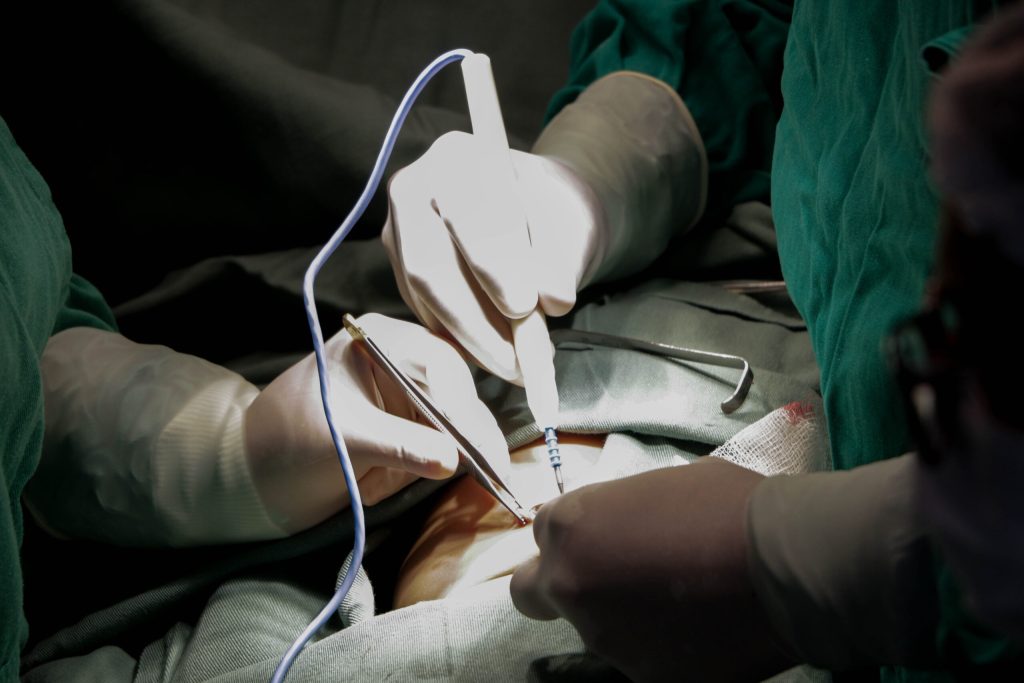 Foto mostrando as mãos dos médicos realizando a cirurgia